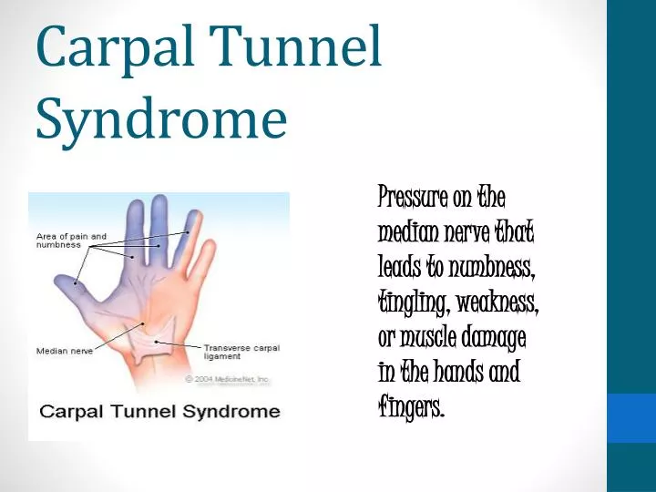 carpal tunnel syndrome physiotherapy management ppt