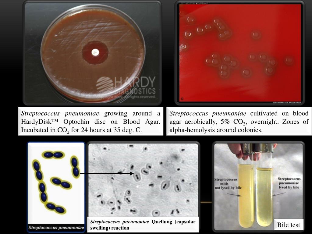 C pneumoniae. Стрептококк пневмония гемолиз. Реакция преципитации пневмококк. Пневмококки рост на средах. Стрептококки и пневмококки культивирование.