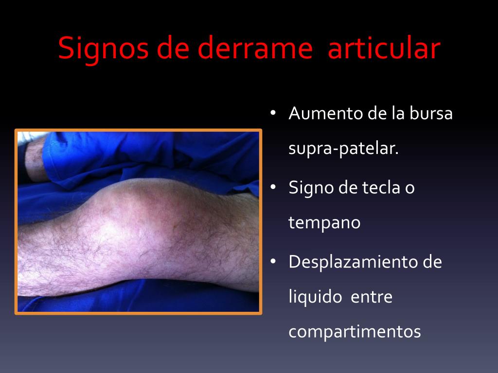 PPT Exploraci n Y Patolog a De Rodilla PowerPoint Presentation Free 