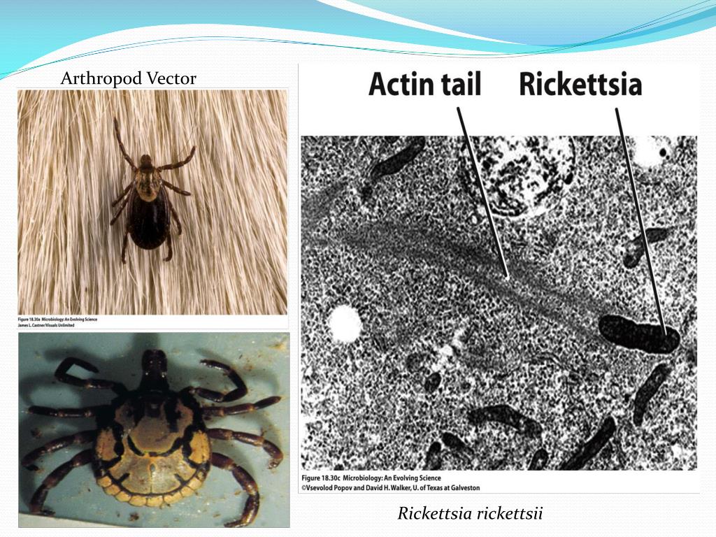 PPT - Rickettsial (Spotted & Typhus Fevers) & Related Infections ...