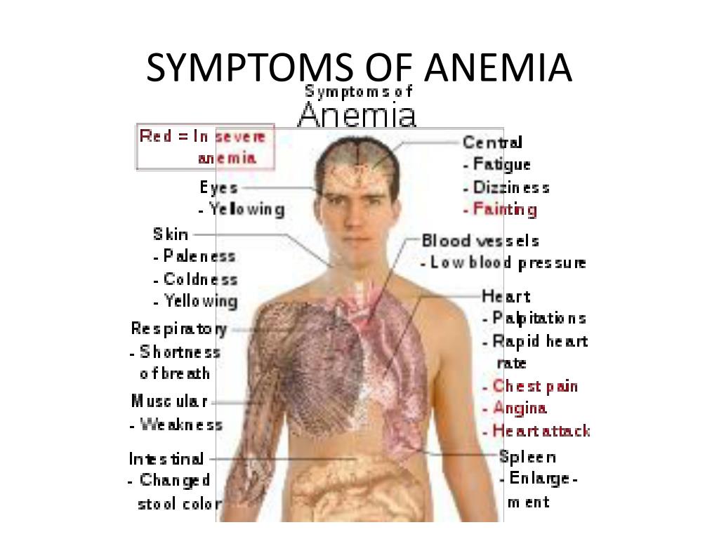 Ppt Anemia Powerpoint Presentation Free Download Id2866227