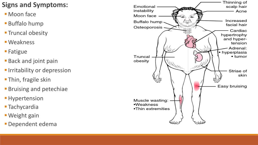 epinephrine disorders epinephrine disorders
