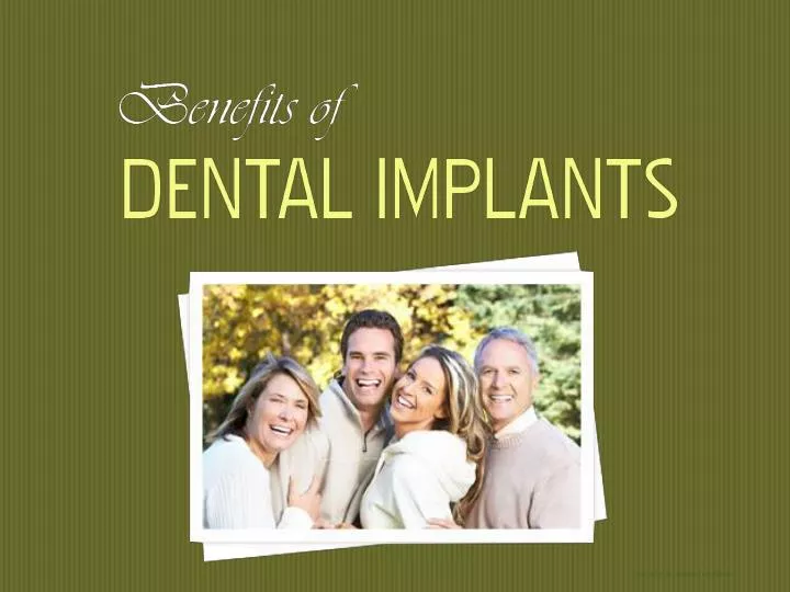 benefits of dental implants n.