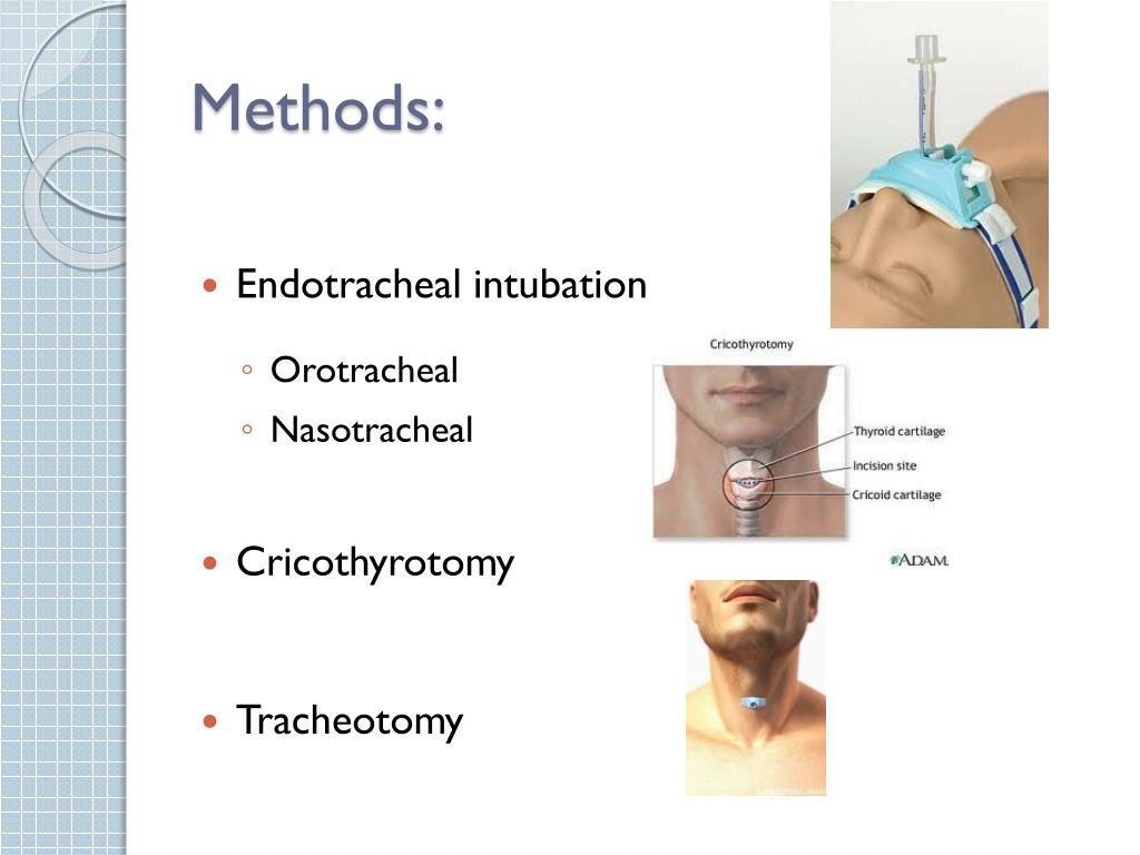 Endotracheal Intubation Vs Tracheostomy