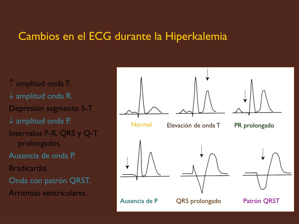 PPT LIQUIDOS Y ELECTROLITOS PowerPoint Presentation Free Download 