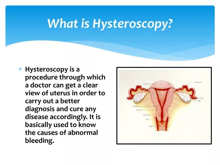 what is hysteroscopy n.