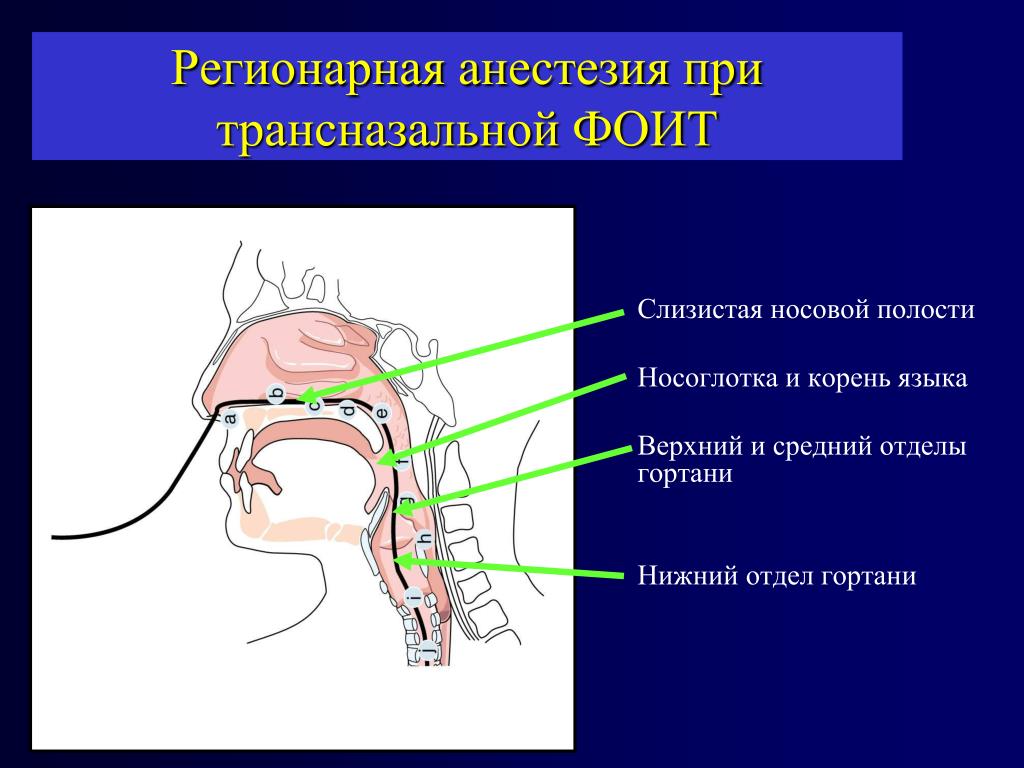 Онемения после анестезии. Обезболивание полости носа. Регионарная анестезия. Анестезия полости носа.