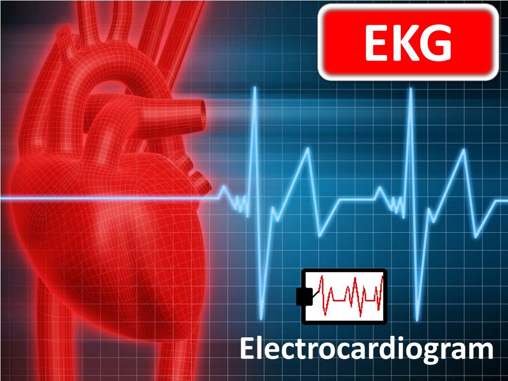 PPT EKG PowerPoint Presentation free download ID:2931216 PPT EKG PowerPoint Presentation free download ID:2931216