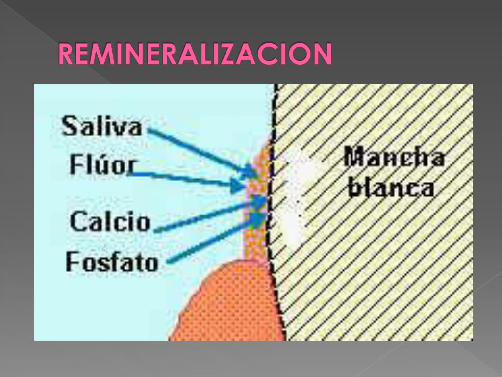 PPT - DESMINERALIZACION Y REMINERALIZACION PowerPoint Presentation