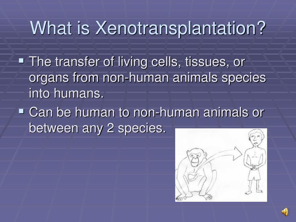 xenotransplantation timelane