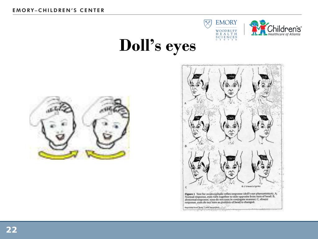 dolls with x for eyes