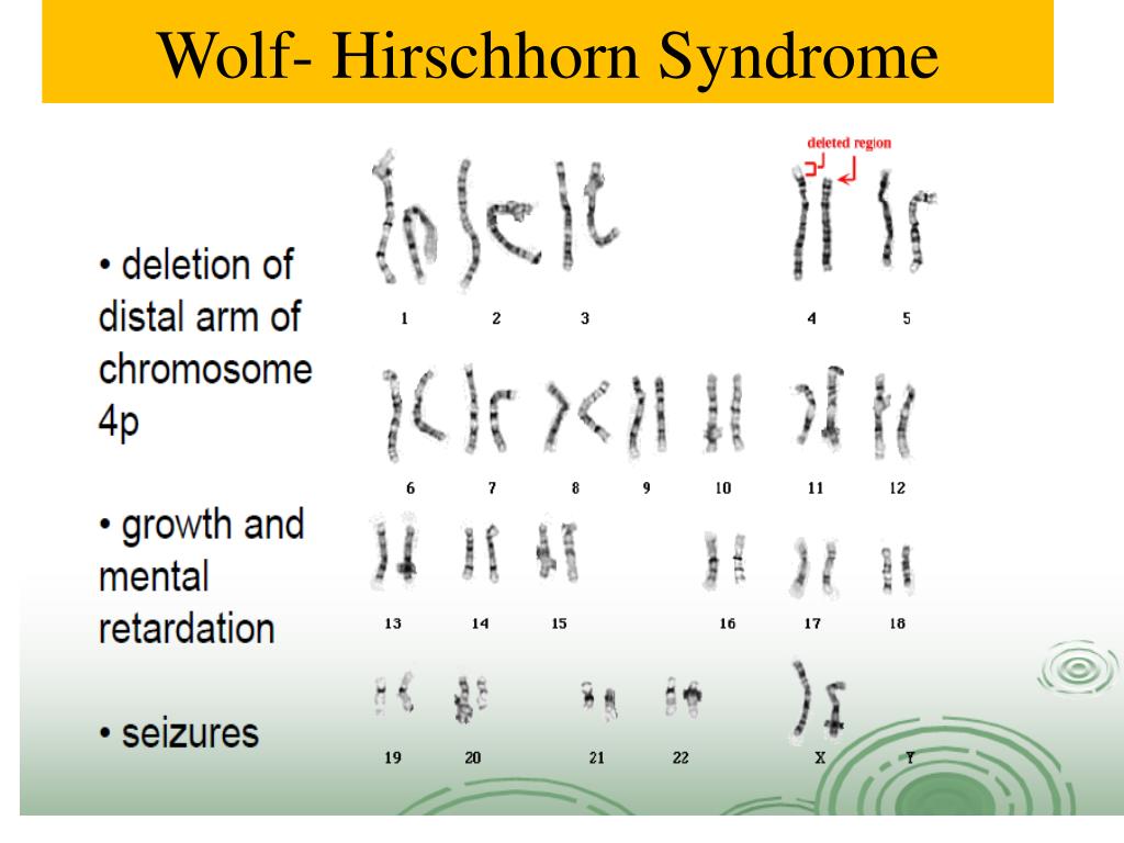 Презентация на тему синдром вольфа хиршхорна
