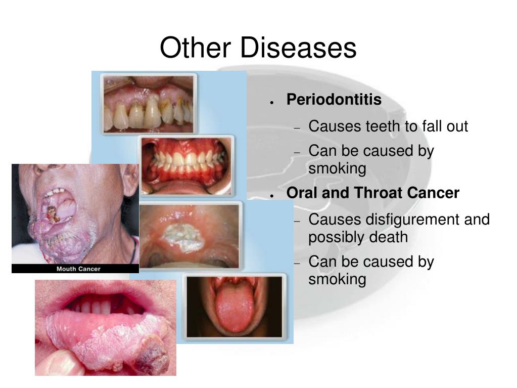 PPT The Affects of Tobacco Smoke on the Human Body PowerPoint