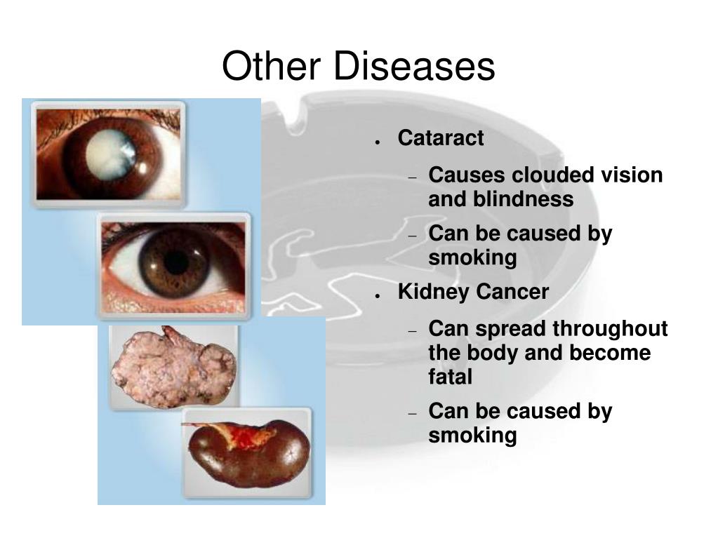 PPT The Affects of Tobacco Smoke on the Human Body PowerPoint