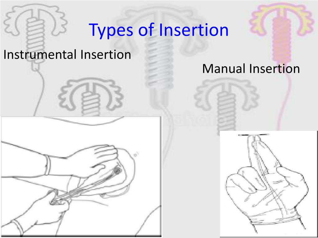 PPT Postpartum Contraception PowerPoint Presentation free download PPT Postpartum Contraception PowerPoint Presentation free download