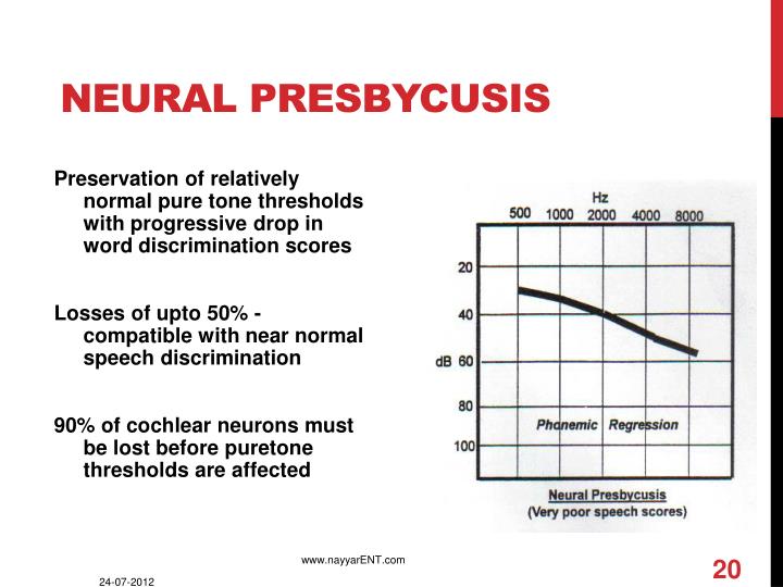 PPT - PRESBYCUSIS PowerPoint Presentation - ID:2957165