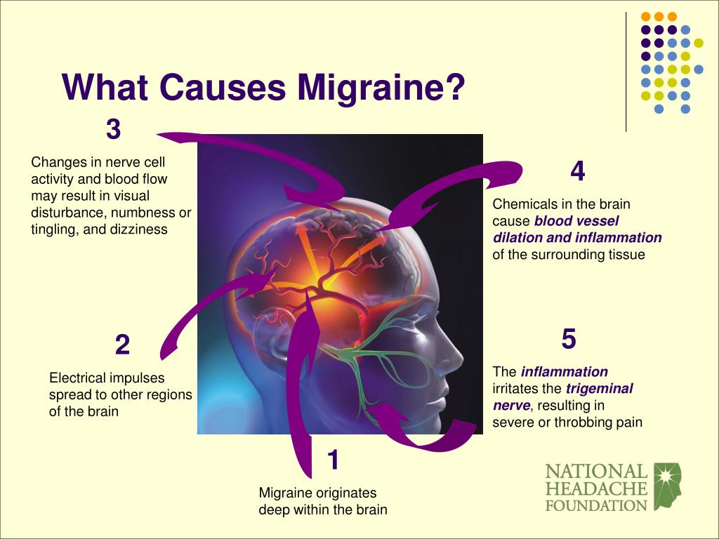 migraine case study ppt