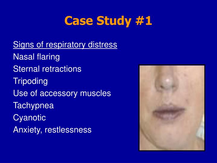 respiratory case study presentation Clinical case presentation group-4 roll no:- 16-20 systemic examination •respiratory system:- inspection:- normal shape,. respiratory case study presentation Clinical case presentation group-4 roll no:- 16-20 systemic examination •respiratory system:- inspection:- normal shape,.