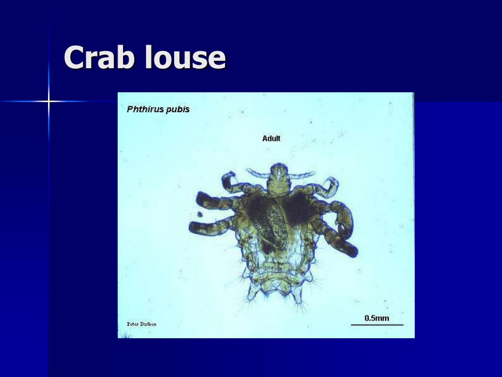 PPT Medical Entomology PowerPoint Presentation, free download ID
