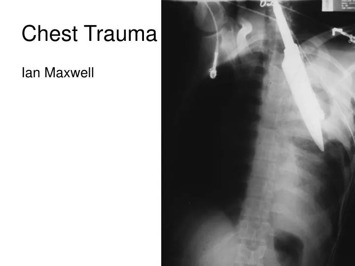 PPT Chest Trauma PowerPoint Presentation, free download ID2970244
