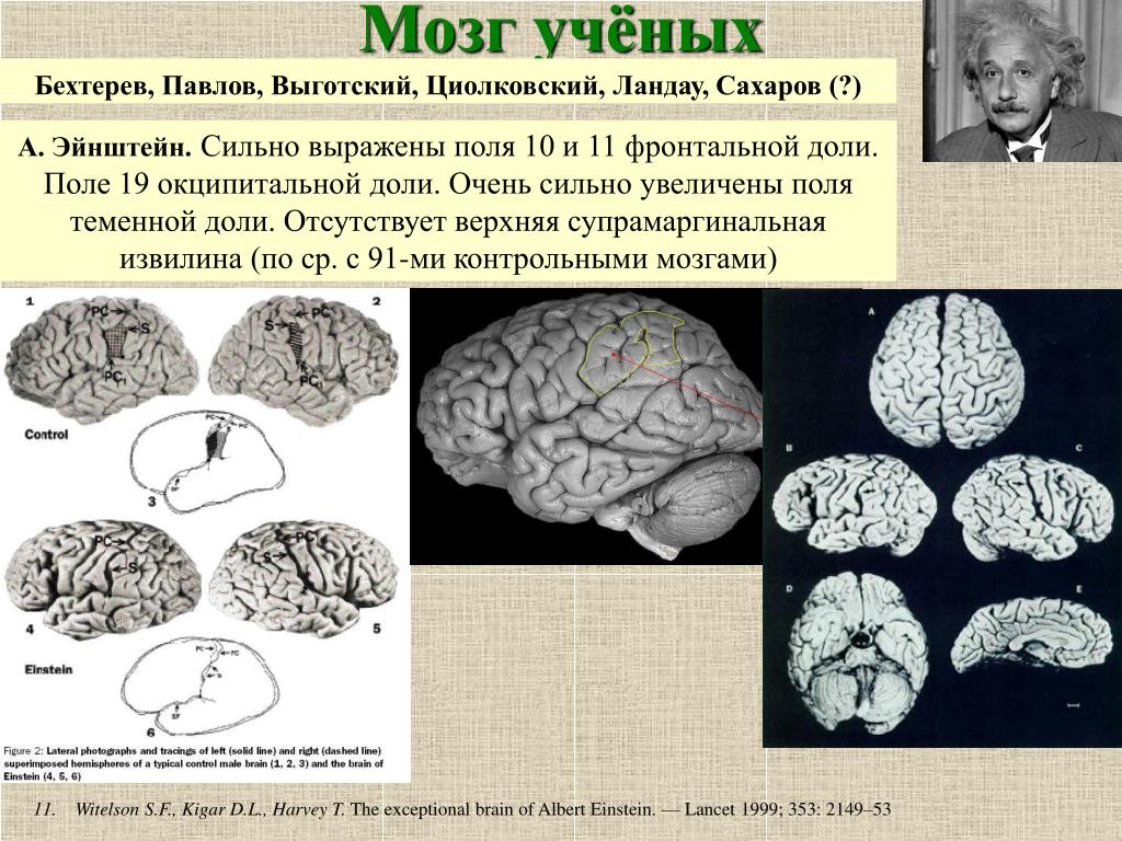 Ученые изучающие мозг