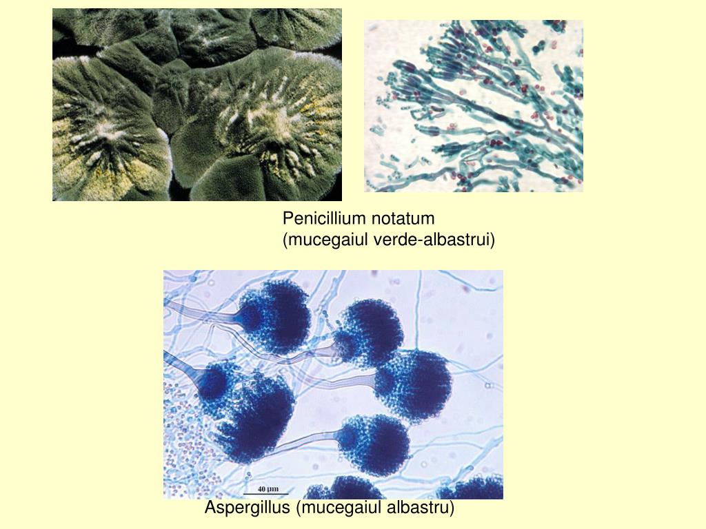 Пеницилл и бактерии. Плесневые грибы сапрофиты. Aspergillus и Penicillium. Гриба пенициллиум нотатум. Грибы рода пенициллиум вызывают заболевания.