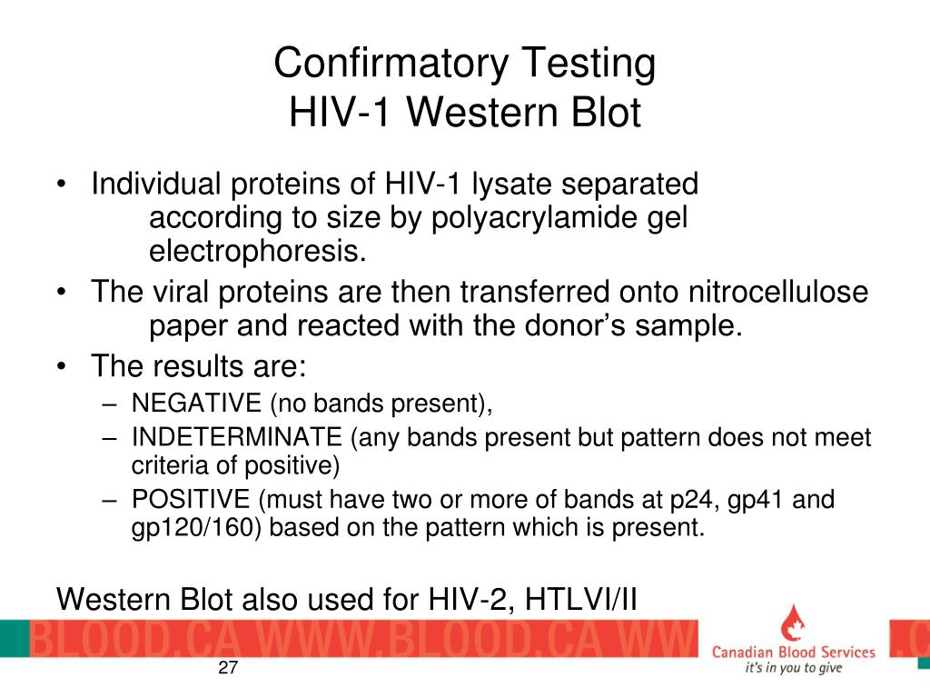 western blot technique hiv western blot technique hiv