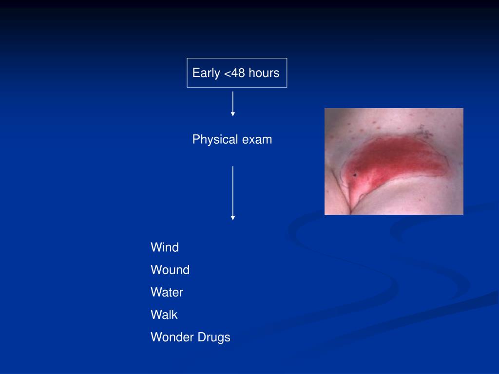 PPT Perioperative Assessments, Pain, Fever, Oliguria and DVT