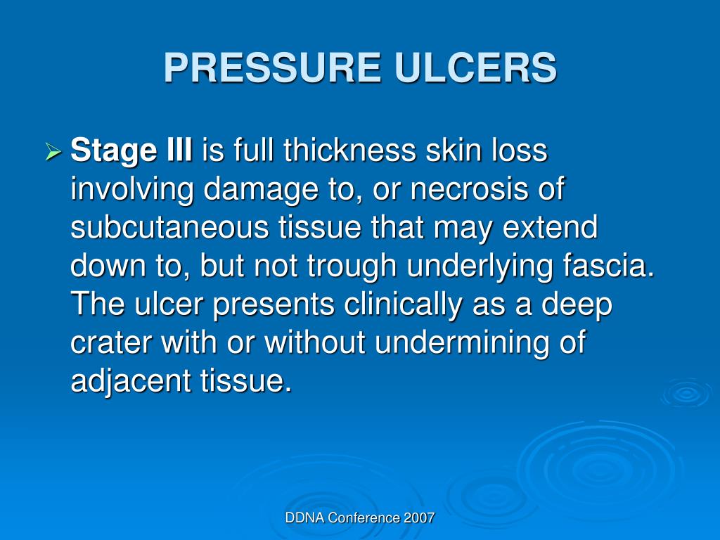 Pressure Ulcer - Stages - Primary Care Provider Resource for Spinal Cord  Injury