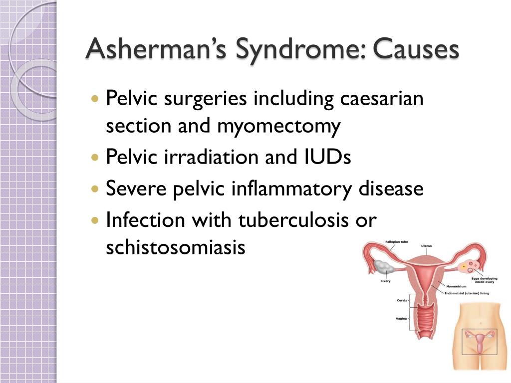 the presentation of asherman's syndrome typically involves