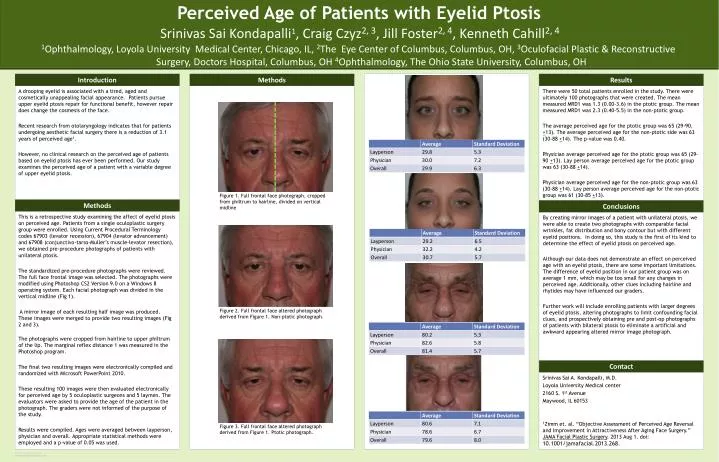 perceived age of patients with eyelid ptosis n.