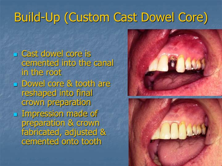 PPT Introduction to Fixed Prosthodontics PowerPoint Presentation ID