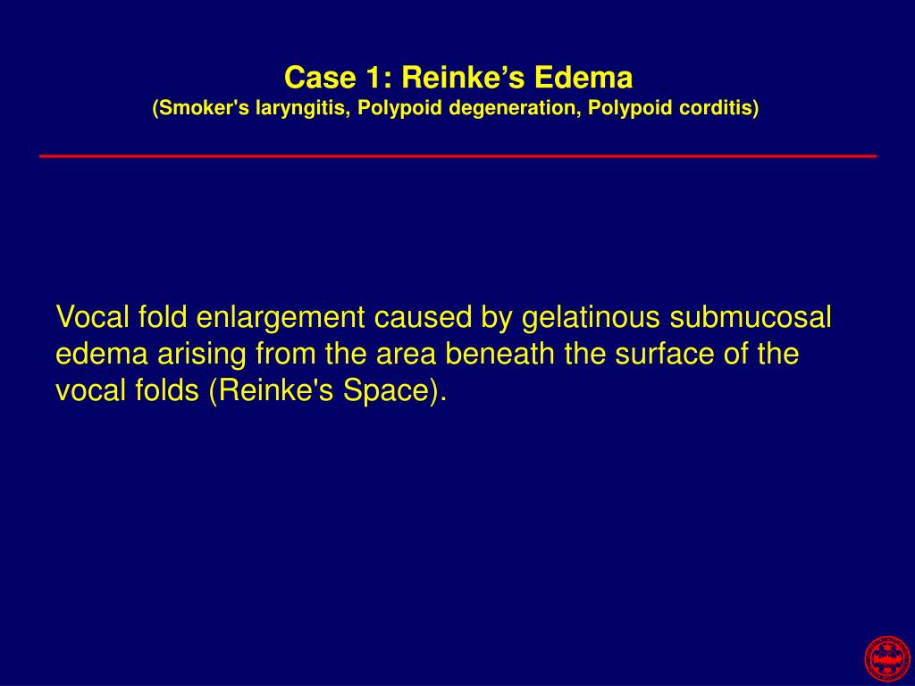 PPT The Difficult Airway Rafael Ortega, M.D. Associate Professor of