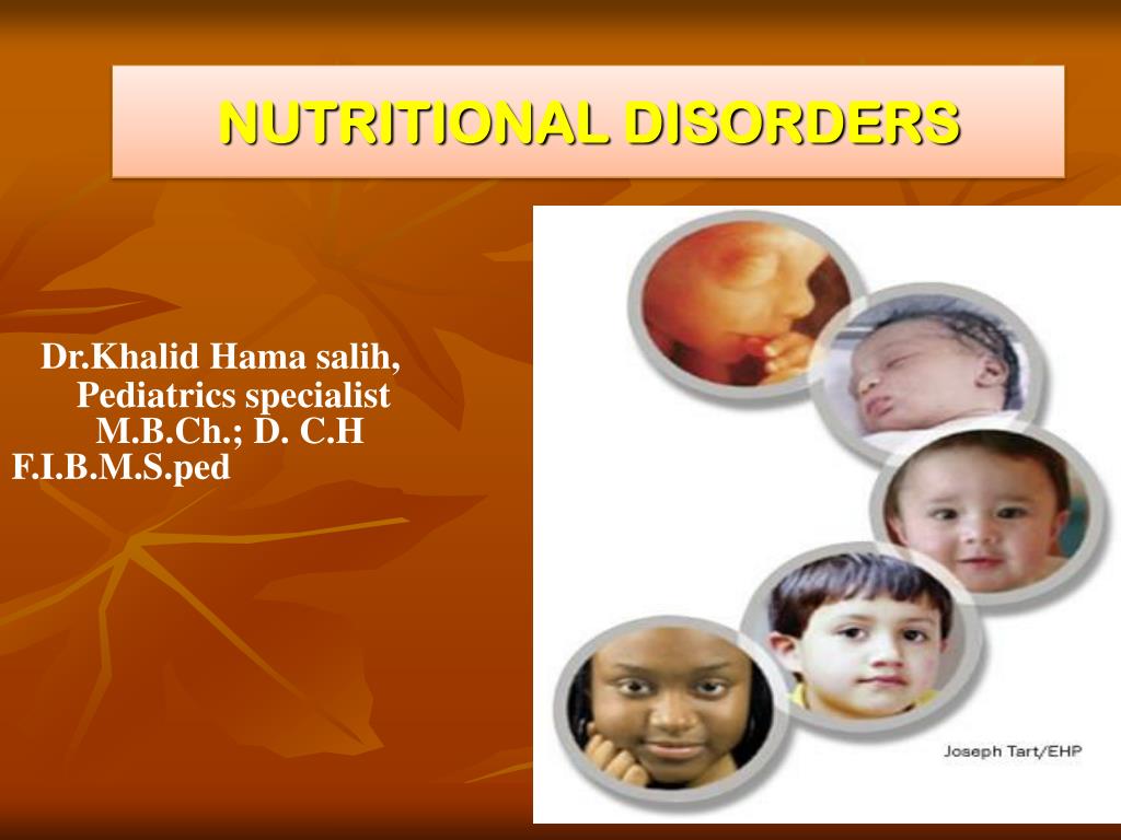 PPT  NUTRITIONAL DISORDERS PowerPoint Presentation, free download  ID