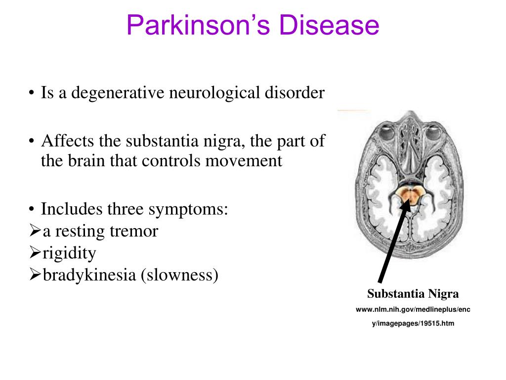 PPT Knowledge and Attitudes Toward Testing in Parkinson’s