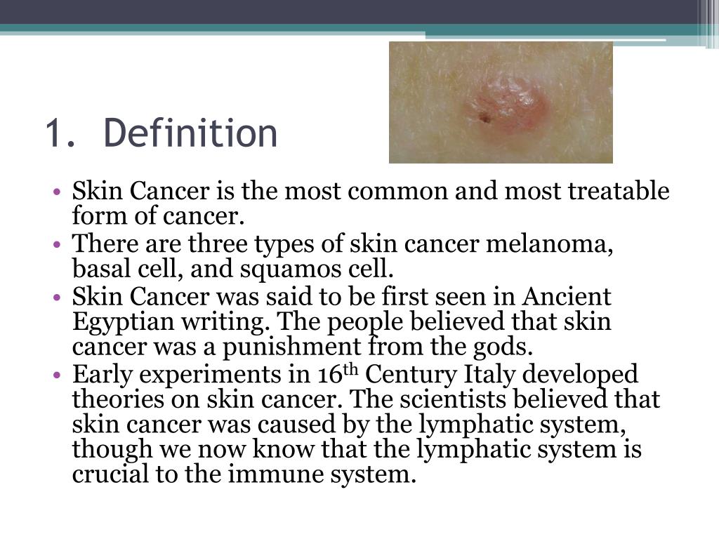 Ppt Skin Cancer Powerpoint Presentation Free Download Id3021048
