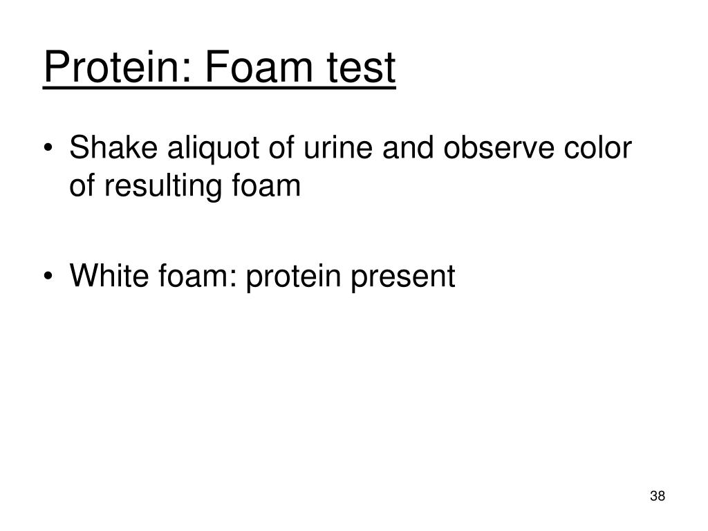 PPT Chemical Examination of Urine PowerPoint Presentation, free download ID3024153