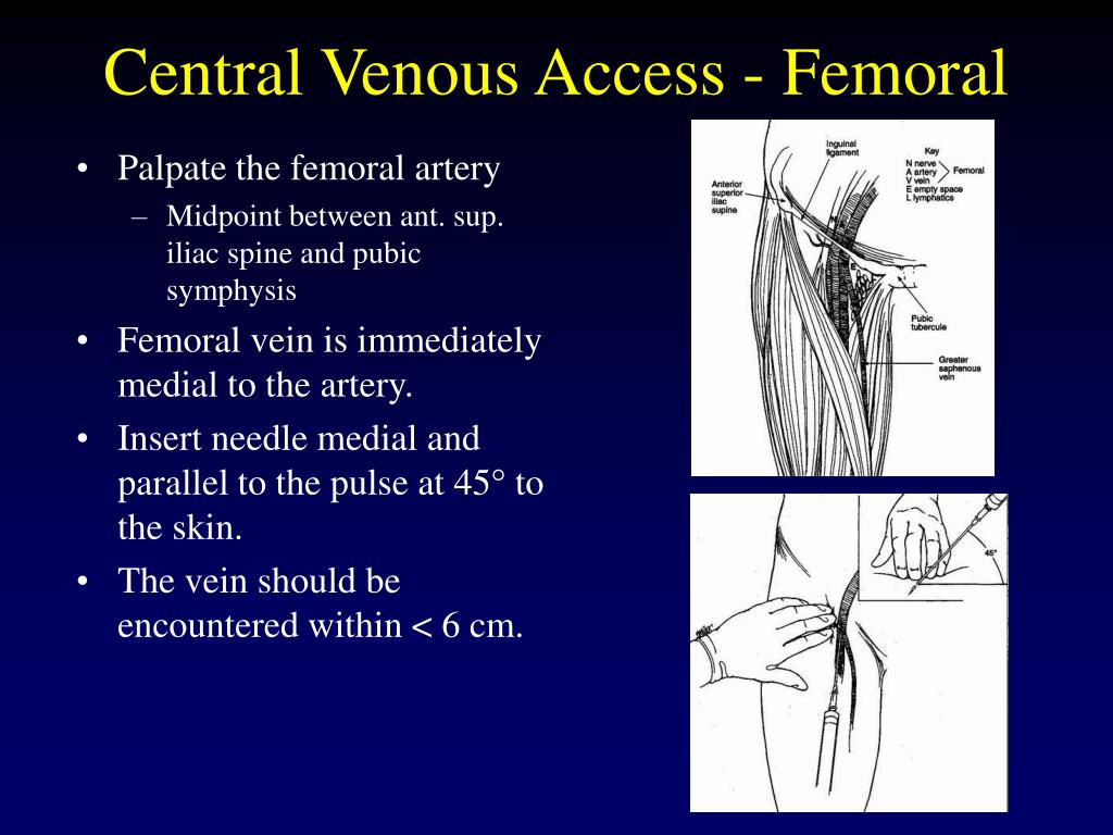 Femoral Pulse Palpation