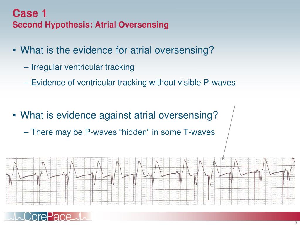 PPT - Pacemaker Troubleshooting Module 9 PowerPoint Presentation, free ...