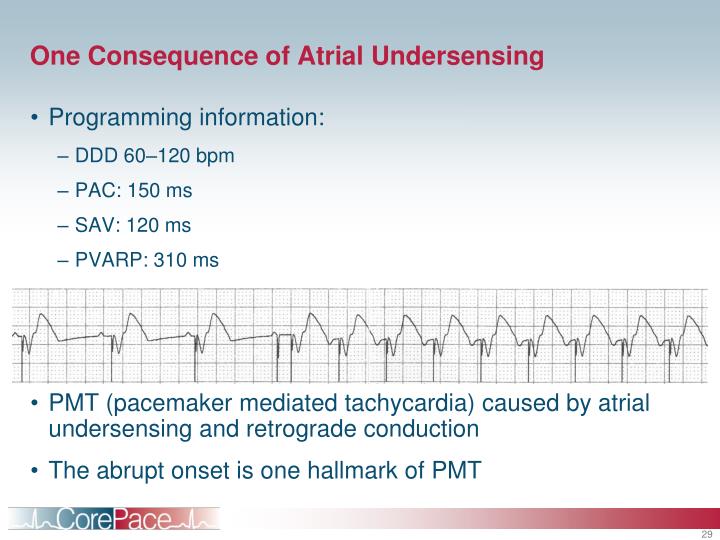 PPT - Pacemaker Troubleshooting Module 9 PowerPoint Presentation - ID ...