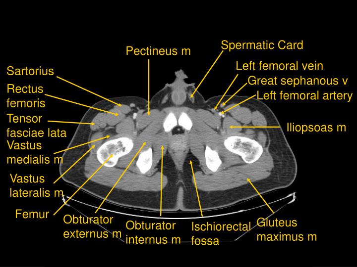PPT CT of Abdomen and Pelvis PowerPoint Presentation ID3031526