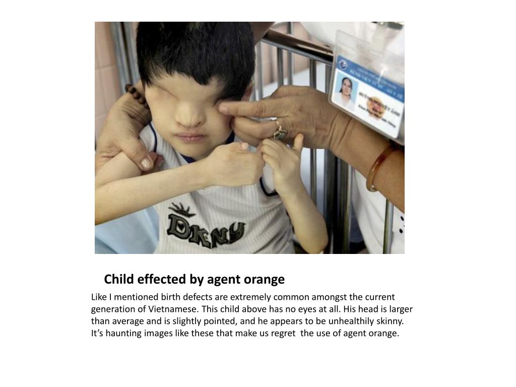 PPT - Agent Orange: Negative Long-term Effects on People and Wildlife ...