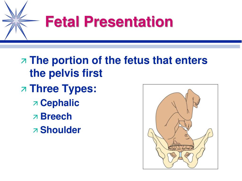 fetal presentation who definition