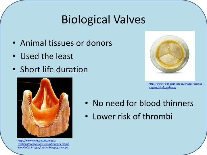 PPT Heart Valves for Congenital Heart Disease Patients PowerPoint