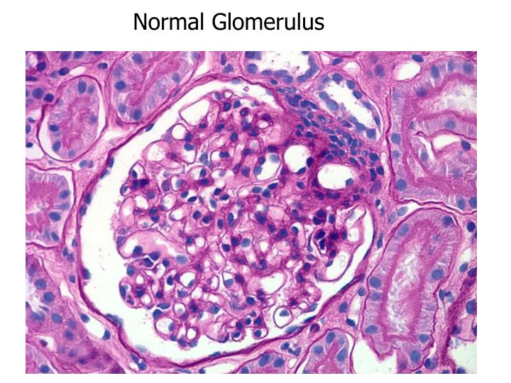 PPT 1 Count all glomeruli determine the number of 