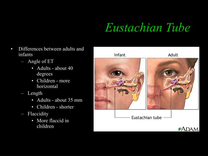 PPT Tympanic Membrane PowerPoint Presentation ID3038672