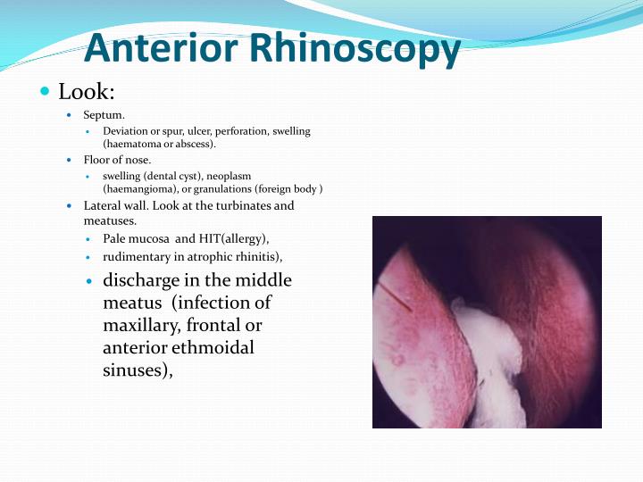 PPT - introduction to ENT History and Clinical Examination PowerPoint ...