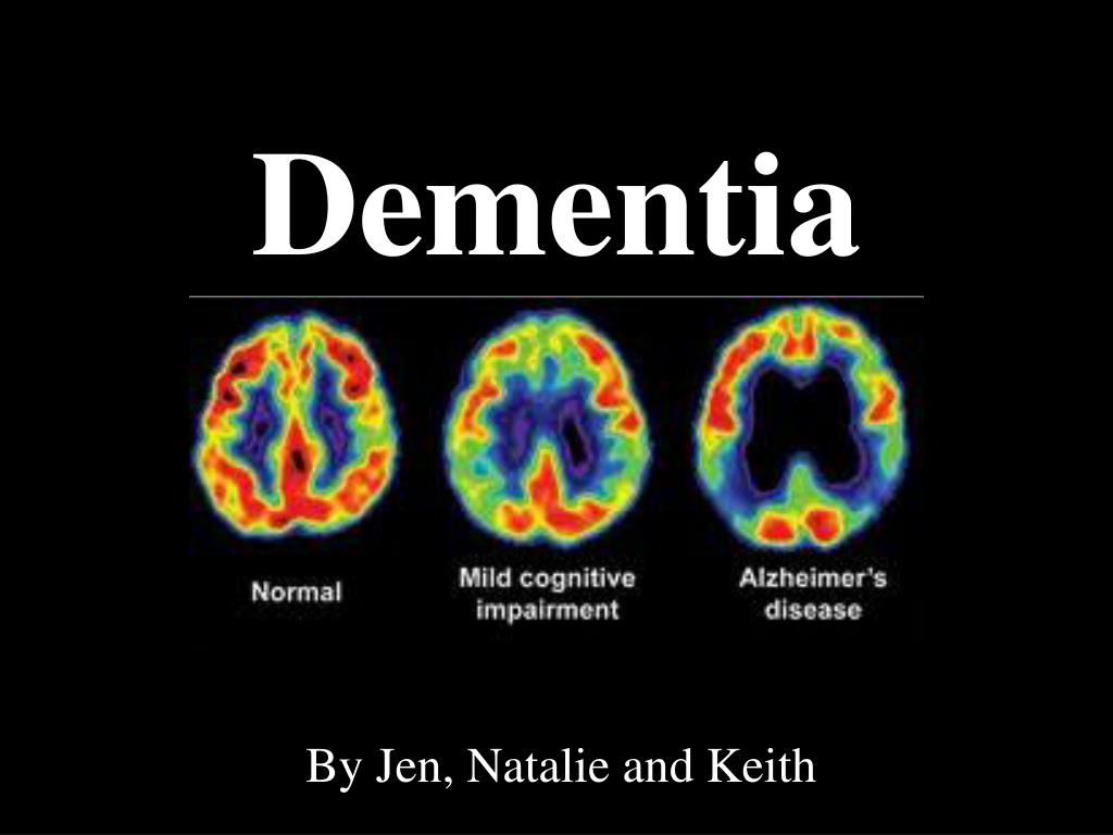 PPT Dementia PowerPoint Presentation Free Download ID 3059274