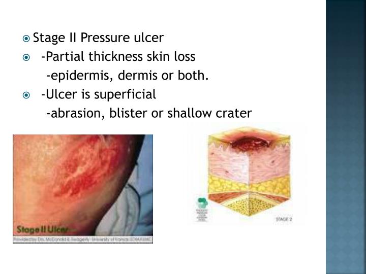 PPT Venous and pressure ulcers PowerPoint Presentation ID3063160