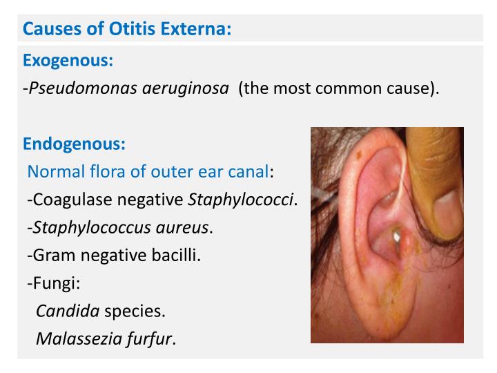PPT Otitis media, Otitis externa , and Eye diseases PowerPoint